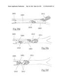 CLOT RETRIEVAL DEVICE FOR REMOVING OCCLUSIVE CLOT FROM A BLOOD VESSEL diagram and image