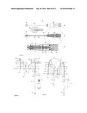 System for Excising Anal Fistula Traces diagram and image