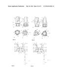 System for Excising Anal Fistula Traces diagram and image