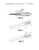 A MULTI-CANNULA SURGICAL INSTRUMENT diagram and image