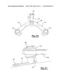 RETRACTABLE BURR HOLE PLATE AND METHOD diagram and image