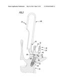 PEDICLE SCREW SYSTEM AND SPINAL STABILIZATION SYSTEM diagram and image