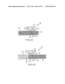 SPINAL CORRECTION SYSTEM ACTUATORS diagram and image