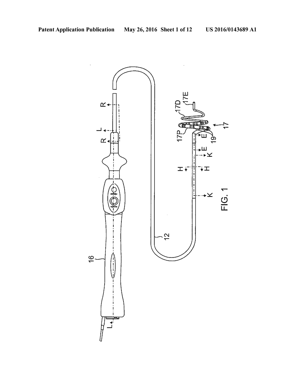 CATHETER WITH SOFT DISTAL TIP FOR MAPPING AND ABLATING TUBULAR REGION - diagram, schematic, and image 02