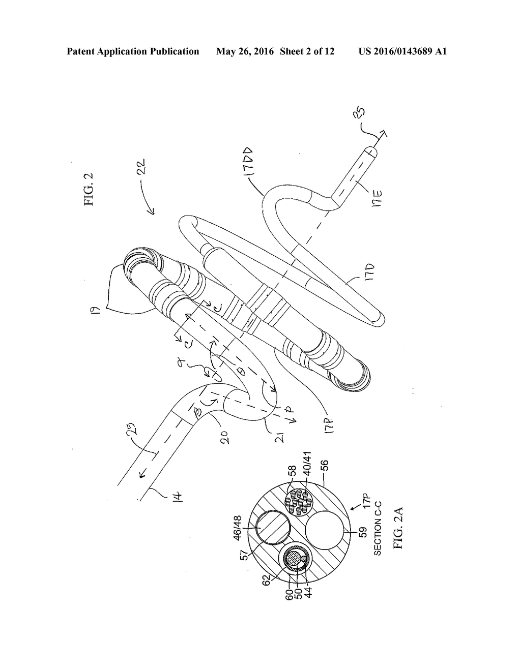 CATHETER WITH SOFT DISTAL TIP FOR MAPPING AND ABLATING TUBULAR REGION - diagram, schematic, and image 03