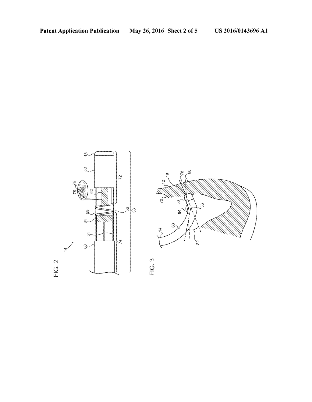 ESTIMATION AND MAPPING OF ABLATION VOLUME - diagram, schematic, and image 03