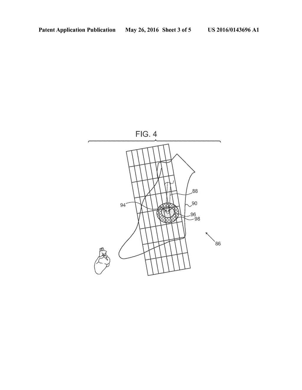 ESTIMATION AND MAPPING OF ABLATION VOLUME - diagram, schematic, and image 04