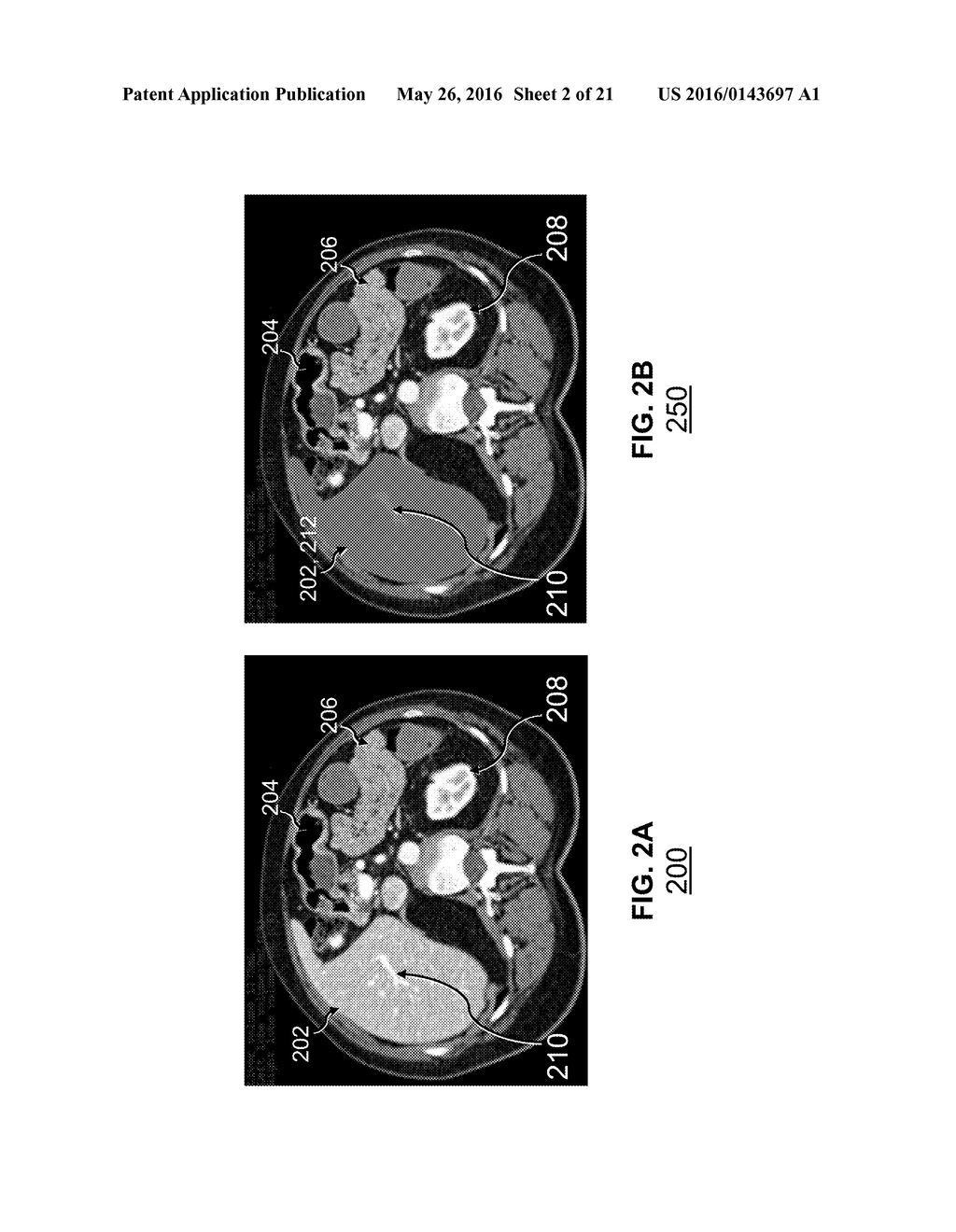 COMPUTER-AIDED PLANNING OF LIVER SURGERY - diagram, schematic, and image 03