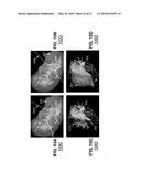 COMPUTER-AIDED PLANNING OF LIVER SURGERY diagram and image