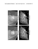 COMPUTER-AIDED PLANNING OF LIVER SURGERY diagram and image