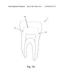 A METHOD AND SYSTEM FOR THE MANUFACTURING OF AN ORAL TEMPLATE FROM A 3D     DIGITAL DATA diagram and image