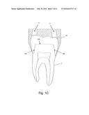 A METHOD AND SYSTEM FOR THE MANUFACTURING OF AN ORAL TEMPLATE FROM A 3D     DIGITAL DATA diagram and image