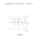 A METHOD AND SYSTEM FOR THE MANUFACTURING OF AN ORAL TEMPLATE FROM A 3D     DIGITAL DATA diagram and image