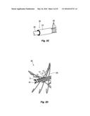 METHODS AND APPARATUS FOR TREATING PULMONARY EMBOLISM diagram and image