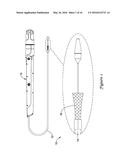 VALVE LOCKING MECHANISM diagram and image