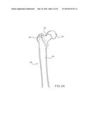 FEMORAL NECK SUPPORT STRUCTURE, SYSTEM, AND METHOD OF USE diagram and image