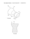 FEMORAL NECK SUPPORT STRUCTURE, SYSTEM, AND METHOD OF USE diagram and image