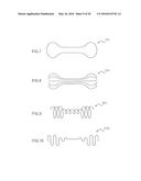 FEMORAL NECK SUPPORT STRUCTURE, SYSTEM, AND METHOD OF USE diagram and image