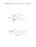 FEMORAL NECK SUPPORT STRUCTURE, SYSTEM, AND METHOD OF USE diagram and image