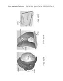 Patient-Adapted and Improved Articular Implants, Designs and Related Guide     Tools diagram and image