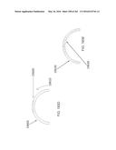 Patient-Adapted and Improved Articular Implants, Designs and Related Guide     Tools diagram and image