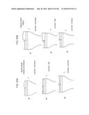 Patient-Adapted and Improved Articular Implants, Designs and Related Guide     Tools diagram and image