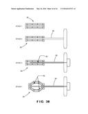 Expandable Inter-Vertebral Cage and Method of Installing Same diagram and image