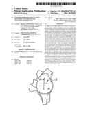 GLENOID COMPONENT INSTALLATION PROCEDURE AND TOOLING FOR SHOULDER     ARTHROPLASTY diagram and image