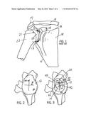 GLENOID COMPONENT INSTALLATION PROCEDURE AND TOOLING FOR SHOULDER     ARTHROPLASTY diagram and image