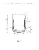 PROSTHETIC SOCKET SUSPENSION DEVICE EMBODIMENTS diagram and image