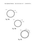 PROSTHETIC SOCKET SUSPENSION DEVICE EMBODIMENTS diagram and image