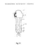 PROSTHETIC SOCKET SUSPENSION DEVICE EMBODIMENTS diagram and image