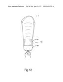 PROSTHETIC SOCKET SUSPENSION DEVICE EMBODIMENTS diagram and image