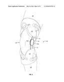 POLYMERIC POLYCENTRIC HINGE diagram and image