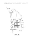 Compression Garment for Postpartum Women diagram and image