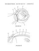 A DEVICE FOR DELIVERY OF COMPOSITIONS TO THE EYE diagram and image