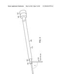 AQUABLATION AQUABEAM EYE SURGERY METHODS AND APPARATUS diagram and image