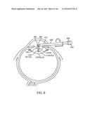 AQUABLATION AQUABEAM EYE SURGERY METHODS AND APPARATUS diagram and image