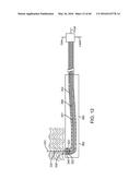 AQUABLATION AQUABEAM EYE SURGERY METHODS AND APPARATUS diagram and image