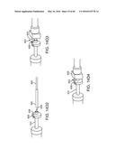 AQUABLATION AQUABEAM EYE SURGERY METHODS AND APPARATUS diagram and image