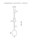 AQUABLATION AQUABEAM EYE SURGERY METHODS AND APPARATUS diagram and image