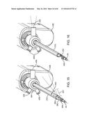 AQUABLATION AQUABEAM EYE SURGERY METHODS AND APPARATUS diagram and image