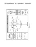 AQUABLATION AQUABEAM EYE SURGERY METHODS AND APPARATUS diagram and image