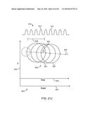 AQUABLATION AQUABEAM EYE SURGERY METHODS AND APPARATUS diagram and image