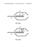 AQUABLATION AQUABEAM EYE SURGERY METHODS AND APPARATUS diagram and image