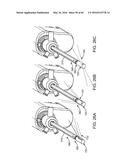 AQUABLATION AQUABEAM EYE SURGERY METHODS AND APPARATUS diagram and image