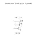 AQUABLATION AQUABEAM EYE SURGERY METHODS AND APPARATUS diagram and image