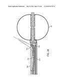 AQUABLATION AQUABEAM EYE SURGERY METHODS AND APPARATUS diagram and image