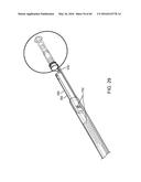 AQUABLATION AQUABEAM EYE SURGERY METHODS AND APPARATUS diagram and image