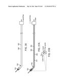 AQUABLATION AQUABEAM EYE SURGERY METHODS AND APPARATUS diagram and image